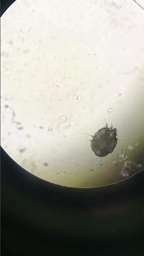 Scabies under microscope. #scabies #dermatology #bestdermatologist