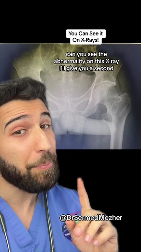 Unveiling the Unexpected: Exploring Humorous and Quirky Discoveries in Radiology