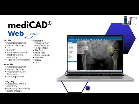 WEBINAR: MedDream Viewer integration with mediCAD orthopedic solutions