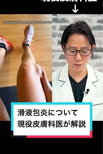 滑液包炎を理解する：皮膚科医の解説
