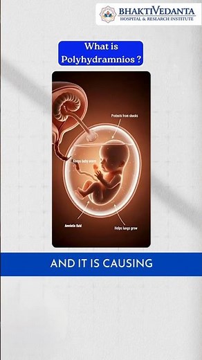 Polyhydramnios High Water Level in Pregnancy Explained by Doctor