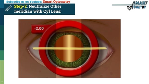 Retinoscopy in 3 Simple Steps (Easiest way to do Refraction) - 检影验光