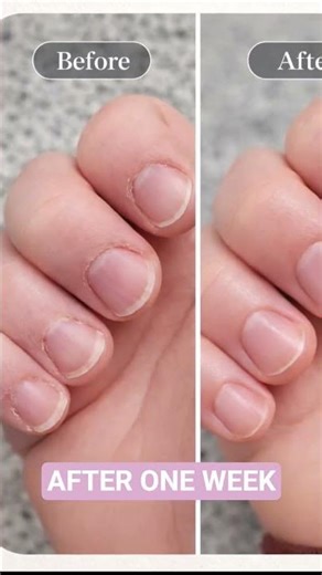 Dry, Cracked Cuticles? This Balm Changed Everything!