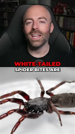 Spy Car, Spiders, Sea Slugs & More Wild Facts!