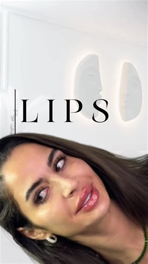 Dr. Diana nur & Dr. Mariam on Instagram: "Dragele mele, astăzi vă arăt un caz absolut spectaculos! ✨ Pacienta a venit cu buze migrate până la nas și mușchii maseteri extrem de dezvoltați. Am ales să topim tot acidul din buze și să aplic botox în mușchii maseteri. Sunteți pregătite să vedeți cum arată după topire? … Superbaaaa! 😍 Iar acum facem pachetul full face… ta daaaa! 💫 Uitați-vă cât de frumoasă este! Și nu ratați before & after-ul… Incredibil, nu-i așa? Fără îndoială, acesta este Cazul A