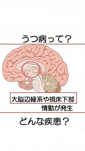 うつ病って？ 診断は？ 脳の障害部位に関して解説！ 【医師が解説】＃Shorts