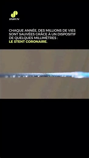 Stuff TV | ❤️🩺 Il s’agit d’un petit treillis métallique inséré par cathéter dans une artère rétrécie afin de la maintenir ouverte et de rétablir le... | Instagram