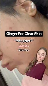Putting Ginger On Your Face For Clear Skin #dermatologist
