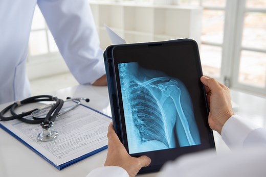 Tips on How to Find the Best Reverse Shoulder Replacement Surgeons | Joint Replacement Institute