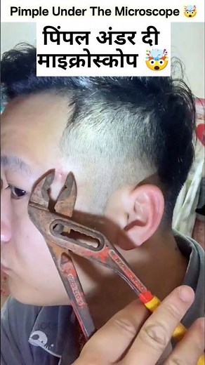 Pimple Under The Microscope #shorts #facts #microscope