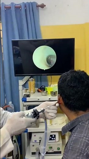 Endoscopic Ear Examination by Doctor 👂🩺 #ENT #MedicalVideo