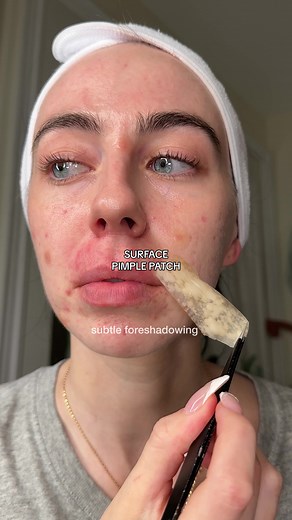 Effective Dermatitis and Pimple Patch Treatment