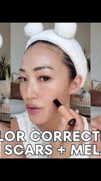 Color Correcting Acne Scars + Melasma + Hyperigmentation
