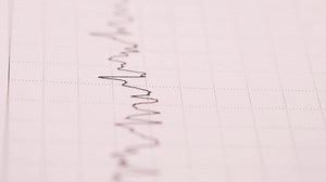 Detail shot of cardio diagram on paper