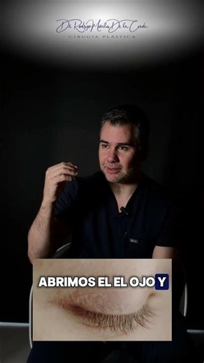 ¿Párpado caído después del bótox? Esto es ptosis