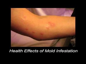 Health Effects of Mold Infestation