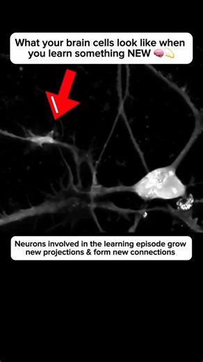 How🤔 your brain🧠 cells look like when you learn something new 😲 #shorts