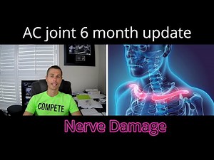 AC joint surgery 6 month update | Nerve damage from distal clavicle resection surgery