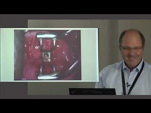 How to use the colposcope & role of colposcopy in the modern world 1