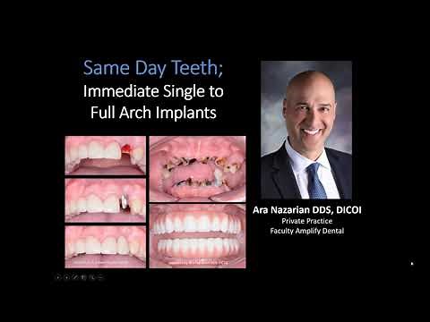 Webinar: Full Arch Guided Dental Implant Techniques - Implant Education