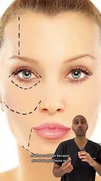 Eyelids sewn shut?! 😳😳