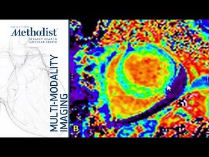 Heart Failure II: How to Evaluate Diastolic Function. (Nagueh, MD & Chamsi-Pasha, MD) Jan. 21, 2020