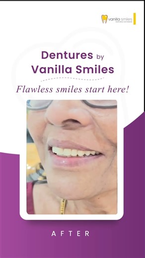 New teeth, new confidence same beautiful you. #Dentures