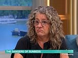 Ex-sunbed user on This Morning urges avoidance after melanoma diagnosis