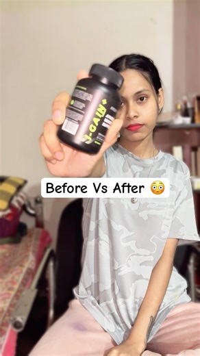 Ayuvya i-Gain Before Vs After😱 #youtubeshorts