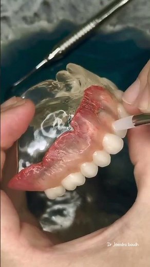 Complete Denture Procedures ||Steps in fabrication of complete denture#dental #dentist
