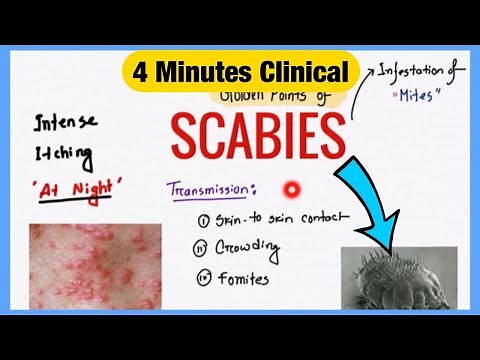 Scabies Spot Diagnosis and Prescription | Symptoms Pathogenesis Treatment | 4 Minutes Clinical