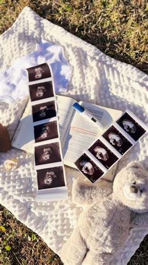 Understanding Early Pregnancy Realizations and Emotions