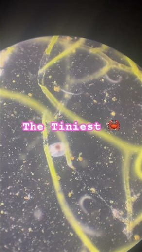 The Tiniest crab & Mr Plankton reef#microscopiclife #microcosm#reeftank#crabs#plankton