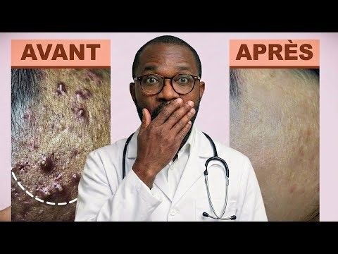 2 Masques Maison Pour Un Lifting Naturel Immédiat (Science Prouvée)