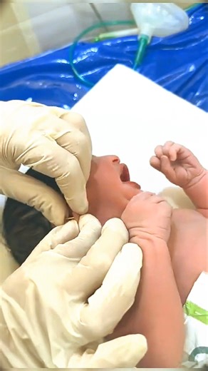 How Nurses Gently Put an Earring on a Newborn Baby | Hospital Care Moments”#newbornbaby #cute #baby