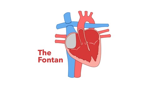 Adult Congenital Heart Assn. on Instagram: "Check out this fascinating animation of #Fontan circulation from science illustrator Fengwei Zhang, an adult with #CHD. Fengwei struggled to find resources, inspiring him to apply his artistry to helping others understand similar heart conditions. Thank you, @fengwei_makes_art, for sharing your creation with our ACHA community! To learn even more about single ventricle defects and the Fontan, visit ACHA's Q&A at https://bit.ly/ACHAFontan. #CHDCare4Life