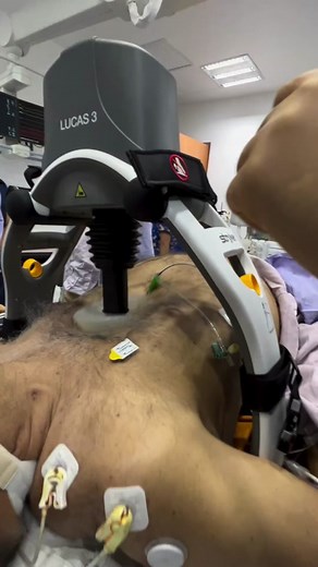 INCREÍBLE!Este robot da masaje cardíaco en un paro cardiorespiratorio, imágenes fuertes! #viral #Impresionante