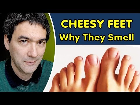 Why do your feet smell like cheese?