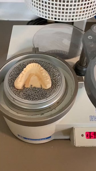 Dental Molding Process for Custom Appliances