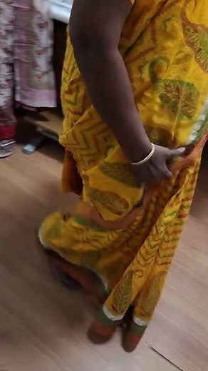 Choreo-athetoid (chorea + athetosis) movements affecting right upper limb- predominantly distal