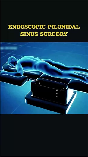 How Surgeons Remove a Painful Pilonidal Sinus | Endoscopic Pilonidal sinus Surgery #surgeryvideo #pilonidalsinus #pilonidalsurgery #sinusremoval #medicalvideo