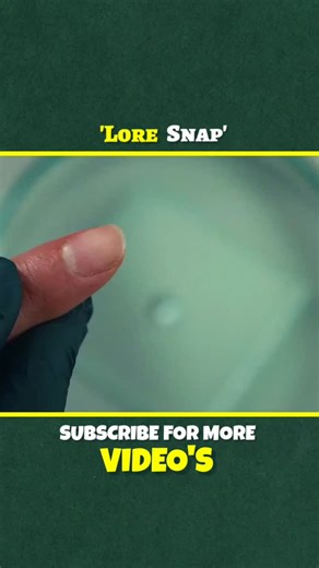 @lore_snap on Instagram: "#mha"