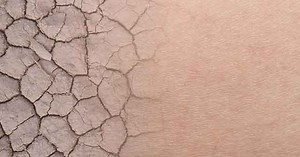 Getting under your skin: Molecular research builds new understanding of skin regeneration