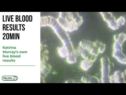 Live Blood Analysis Video - Thank you Katrina Murray