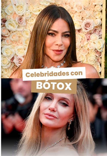 El bótox no cambia tu rostro, pero sí te ayuda a rejuvenecer sin perder tu expresión. 🥰 Es un tratamiento de medicina estética que, aplicado en puntos estratégicos, relaja los músculos del rostro, ayudando a atenuar las líneas de expresión y a lograr un aspecto más descansado y armónico. ☺️ 🙎🏻‍♀️ Se puede aplicar en zonas como la frente, entrecejo y patas de gallo. 🤩 Ayuda a prevenir la formación de nuevas arrugas. ⭐ Brinda resultados naturales visibles a los pocos días. 💉 Es un procedimien