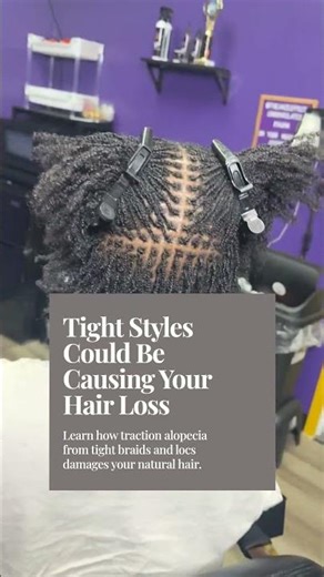 Understanding Alopecia in African American Hair