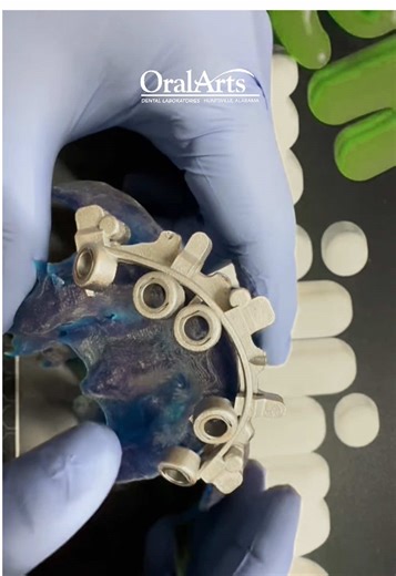 Stackable dental implant guides ✅ #surgicalguides #dentalimplant #dentallaboratory
