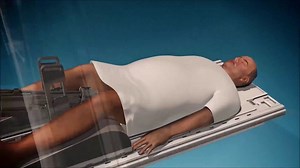 Ultrasound destroys 80 percent of prostate cancers in one-year study – Lifeboat News: The Blog