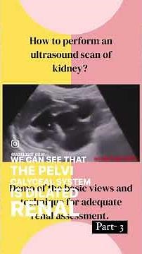 How to perform a basic kidney ultrasound? Demonstration by a radiologist. 2nd clip of part 3.