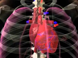 Kammerflimmern und Defibrillation